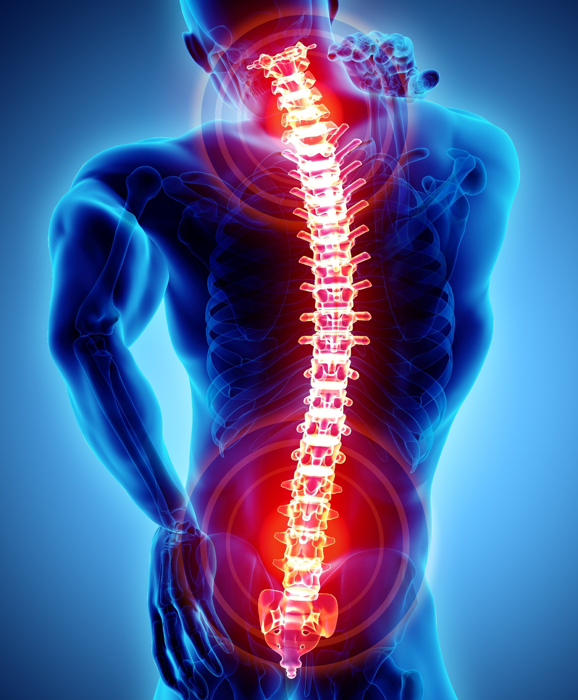 What Is a Spinal Laminectomy and How Does It Work?